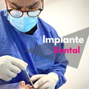Implantes dentales