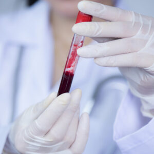 Servicio Avilab